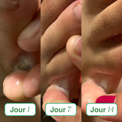 Sereya – Le savon antifongique doux pour peaux sensibles